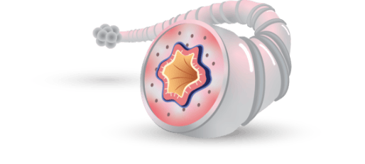 ICS (fluticasone furoate) reduces inflammation